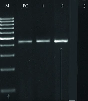 Zahedan J Res Med Sci